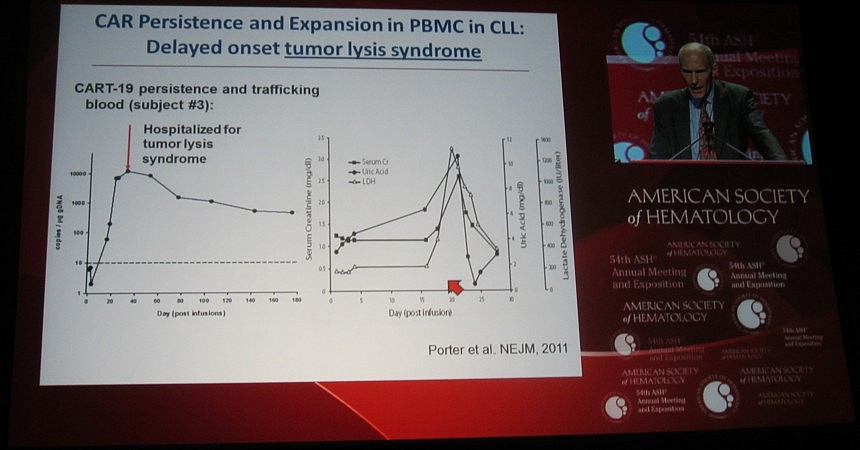 Tumor Lysis Syndrome in CLL CTL019